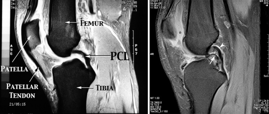 Test Your X Ray Iq Knee Pain Airrosti