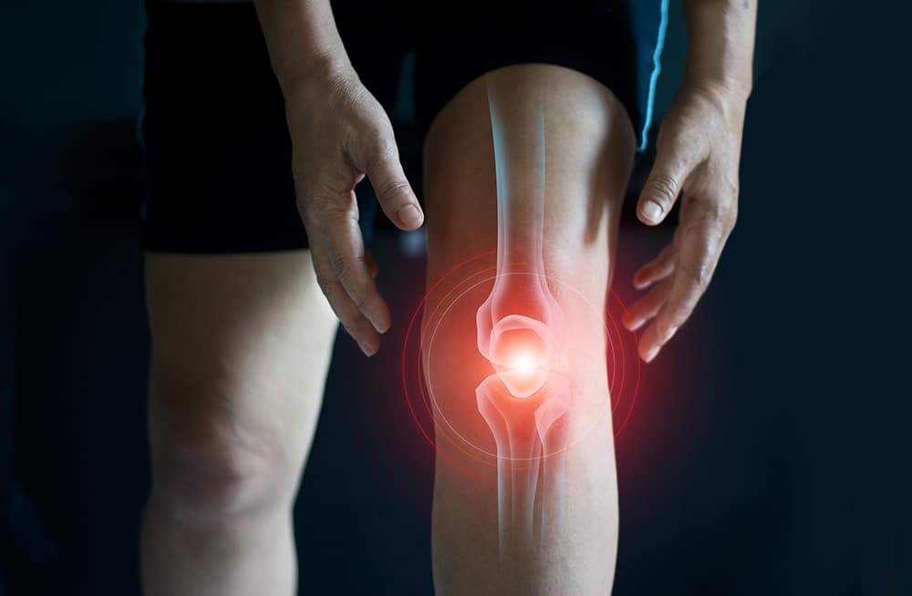 knee pain xray