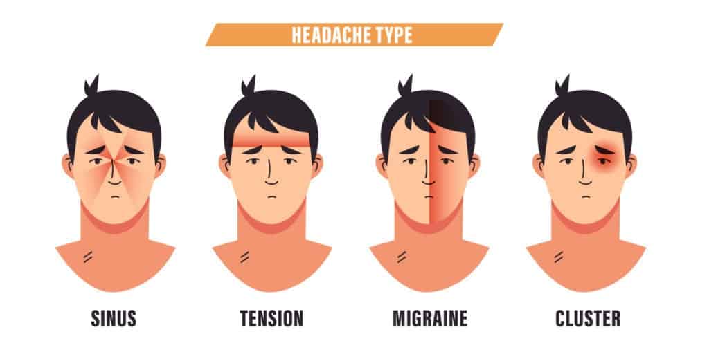 Tension Headaches: Symptoms, Causes, Diagnosis & Treatment | Airrosti