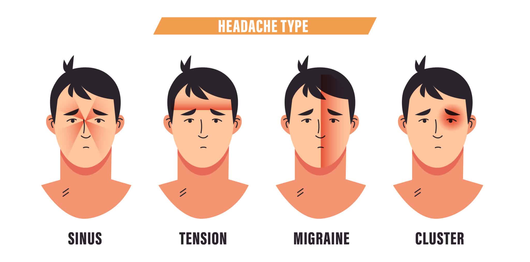 Что значит сильная голова. Types of headache. SUNCT синдром. Tension Type headache. Бас головная боль.