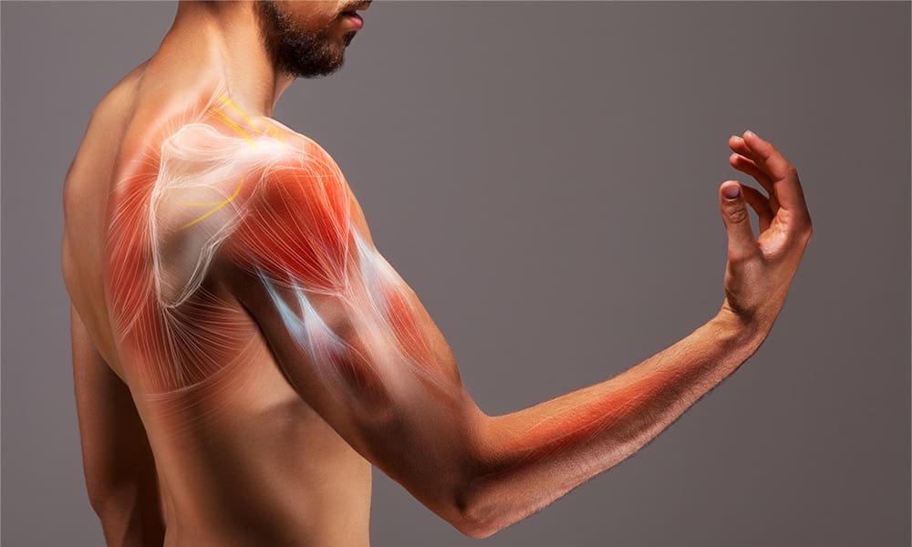 The Neck and Shoulder Pain Muscle (How to Release It for INSTANT RELIEF) 