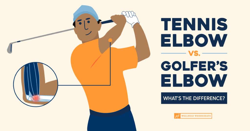 Tennis Elbow vs. Golfer's Elbow: What's the Difference?