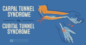 Carpal Tunnel Syndrome vs. Cubital Tunnel Syndrome