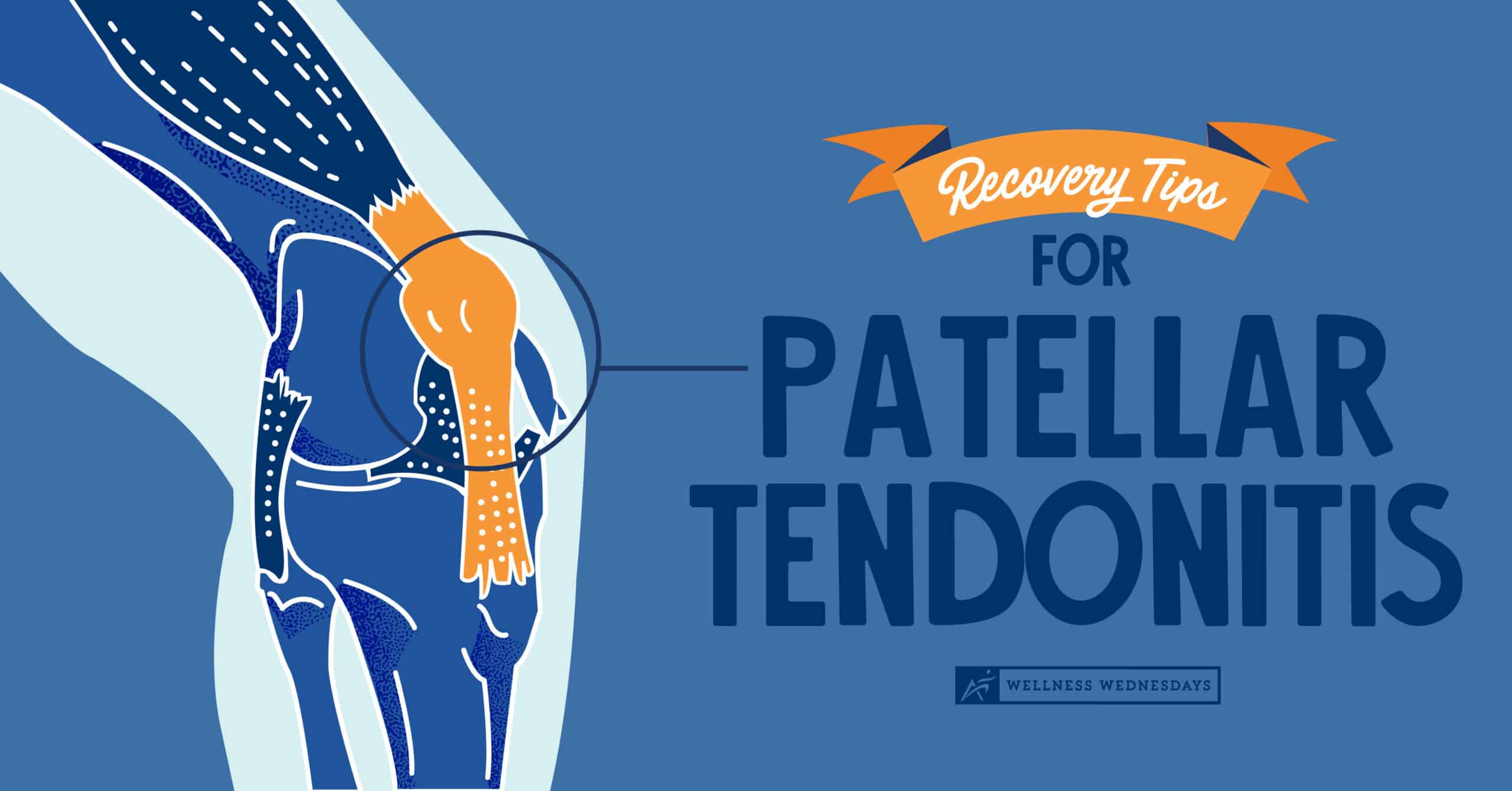 Recovery Tips for Patellar Tendonitis